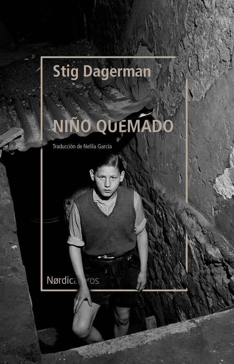 Niño quemado.