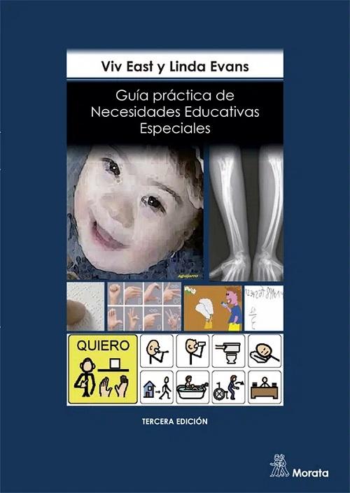 Guía práctica de necesidades educativas especiales. 