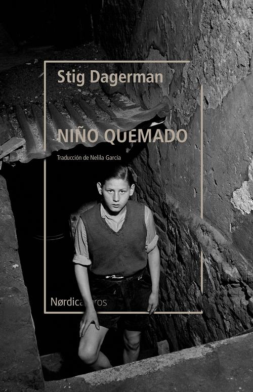 Niño quemado. 